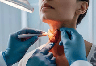 Thyroid Artery Embolization