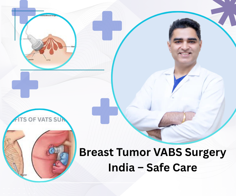 Breast Tumor VABS Surgery India – Safe Care