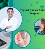 Thyroid Nodule Treatment Bengaluru