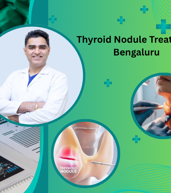 Thyroid Nodule Treatment Bengaluru