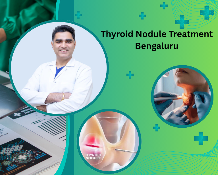 Thyroid Nodule Treatment Bengaluru