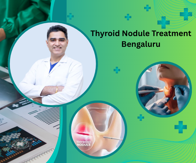 Thyroid Nodule Treatment Bengaluru
