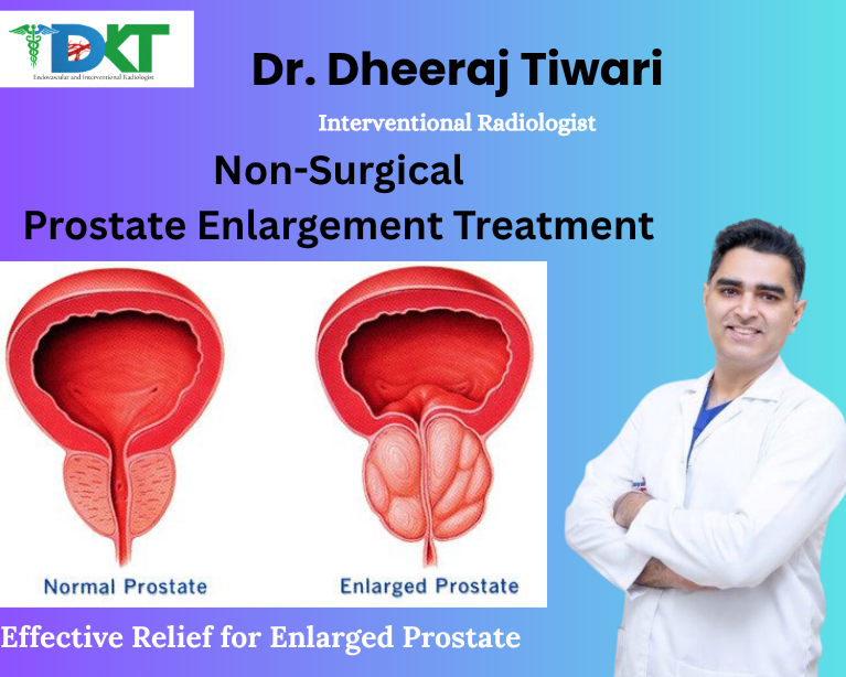 Non-Surgical Prostate Enlargement Treatment
