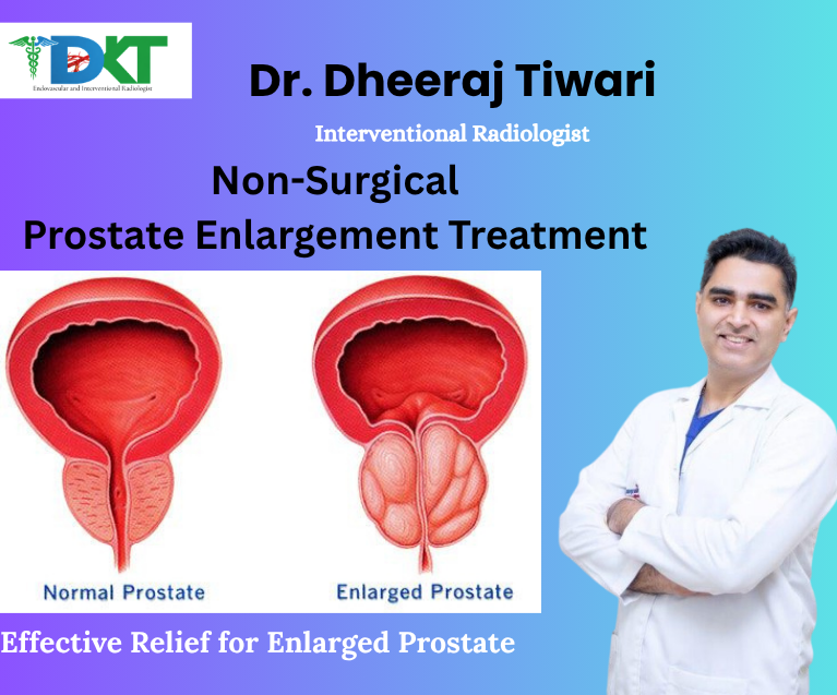 Non-Surgical Prostate Enlargement Treatment