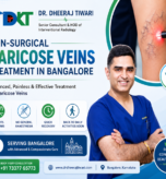 Non-Surgical Varicose Veins Treatment