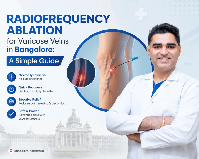 Radiofrequency Ablation for Varicose Veins in Bangalore