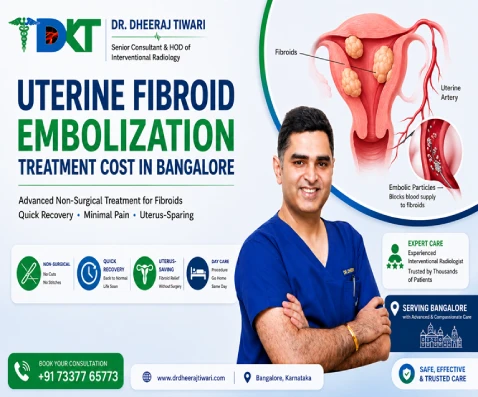 Uterine Fibroid Embolization Treatment Cost