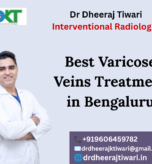 Best Varicose Veins Treatment in Bengaluru