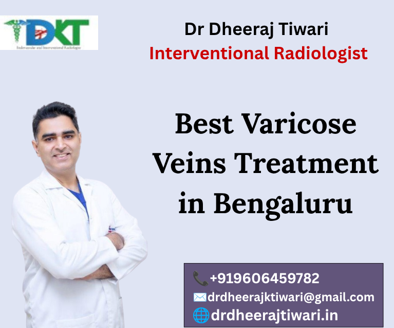 Best Varicose Veins Treatment in Bengaluru