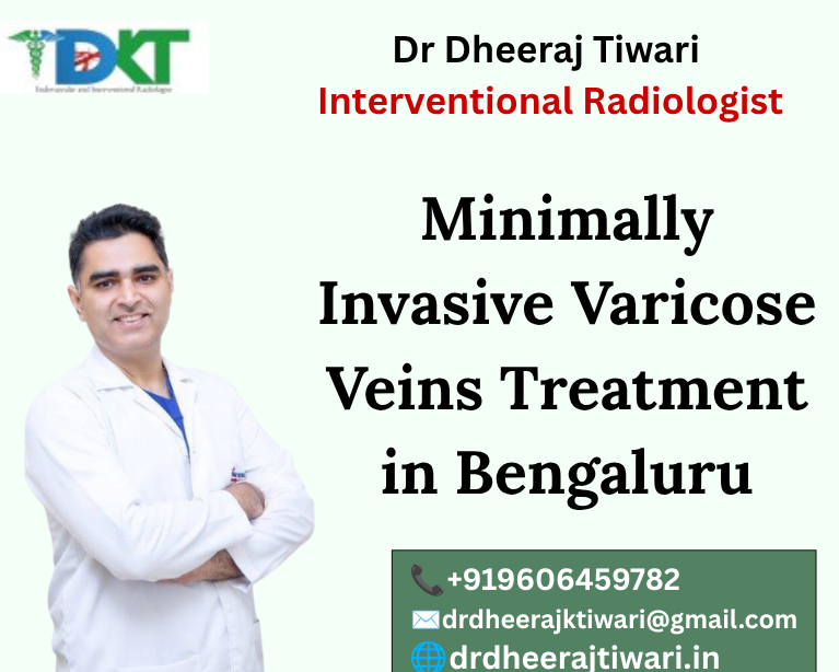 Varicose Veins Treatment in Bengaluru