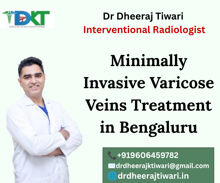 Varicose Veins Treatment in Bengaluru