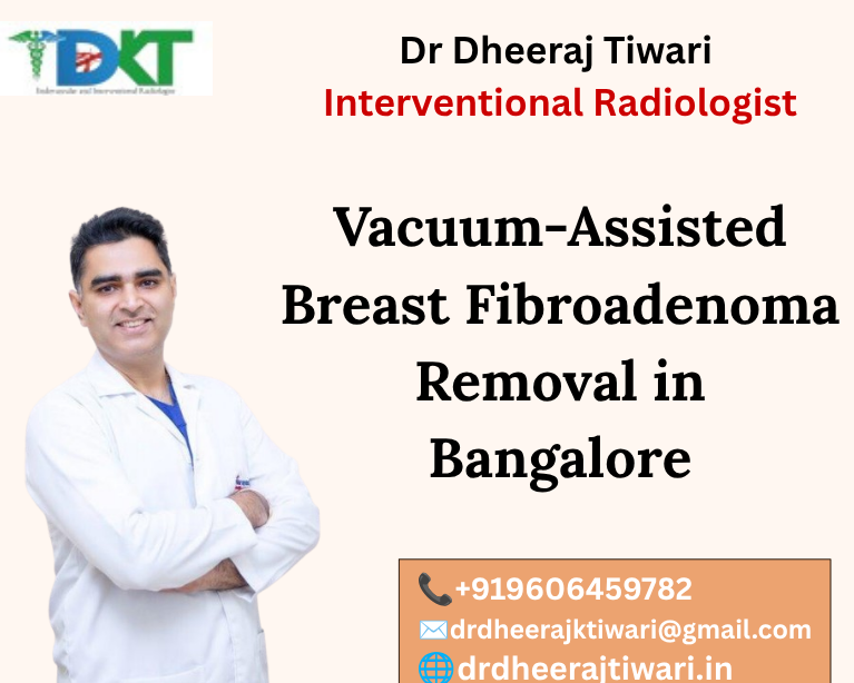 Vacuum-Assisted Breast Fibroadenoma Removal