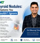 Thyroid Nodules Symptoms You Shouldn't Ignore