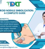 Thyroid Nodule Embolization Gudie