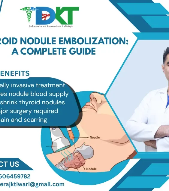 Thyroid Nodule Embolization Gudie