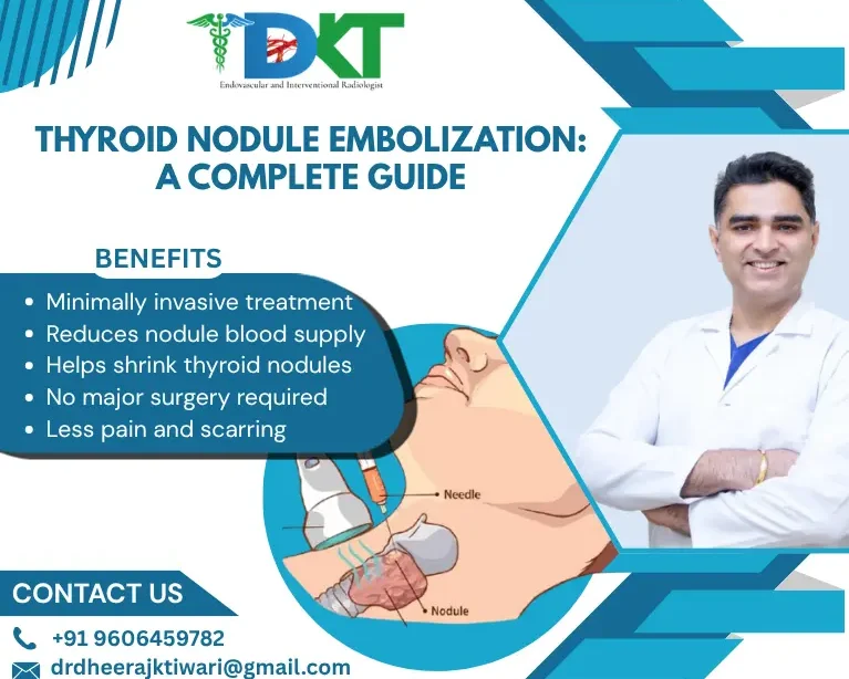 Thyroid Nodule Embolization Gudie