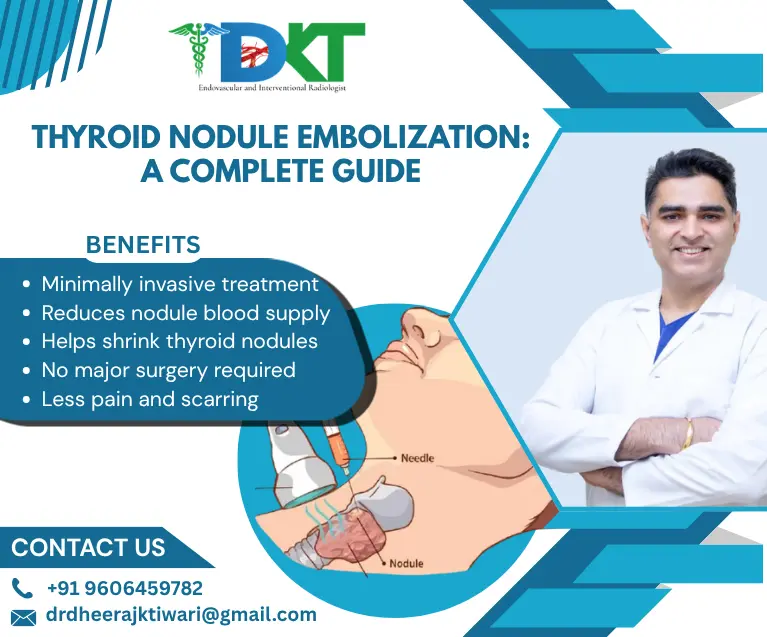 Thyroid Nodule Embolization Gudie