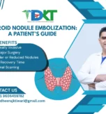 Thyroid Nodule Embolization A Patient’s Guide