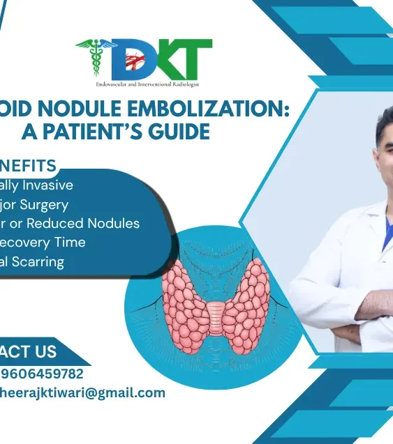 Thyroid Nodule Embolization A Patient’s Guide