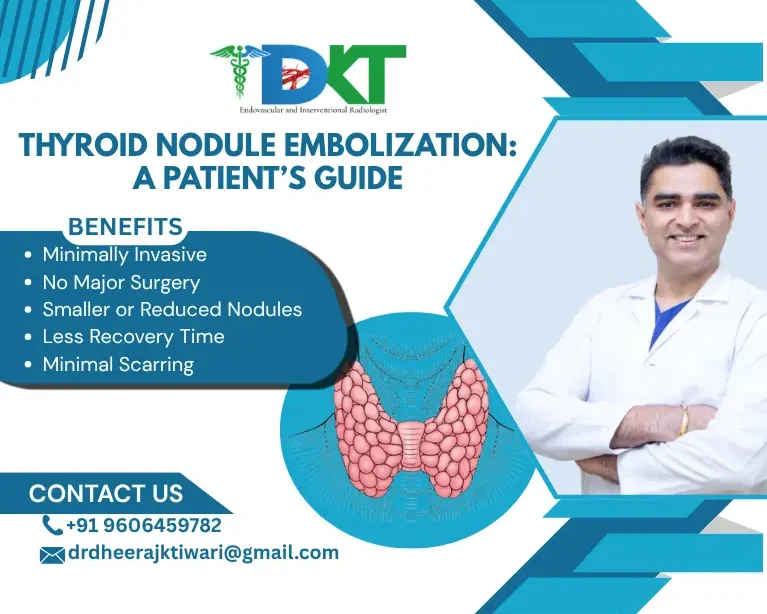 Thyroid Nodule Embolization A Patient’s Guide