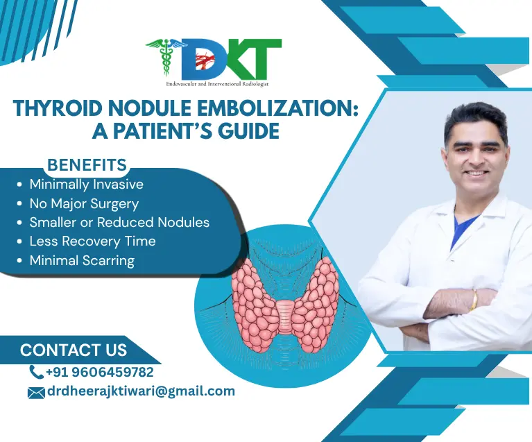 Thyroid Nodule Embolization A Patient’s Guide