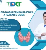 What to Know About Thyroid Nodule Embolization