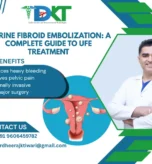Uterine Fibroid embolization guide
