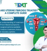Uterine Fibroids Treated? Surgical & Non-Surgical Options