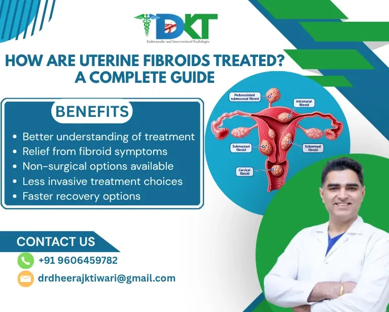 Uterine Fibroids Treated? Surgical & Non-Surgical Options