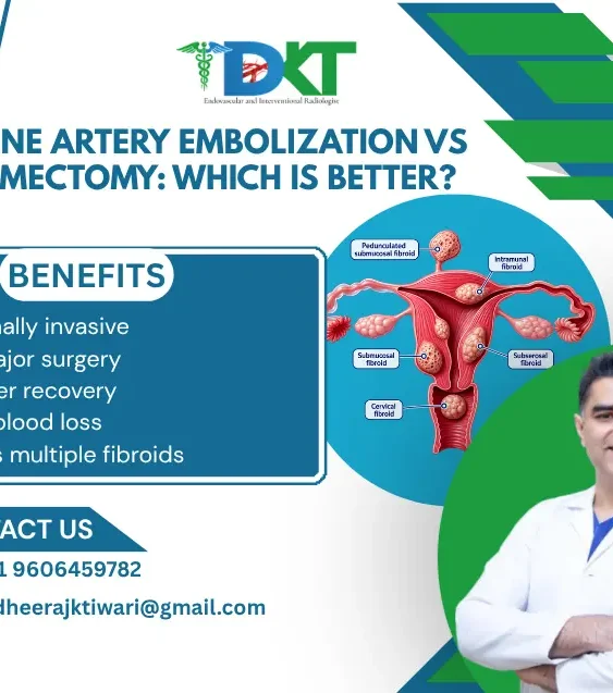 Uterine Artery Embolization vs Myomectomy: Which Is Better?
