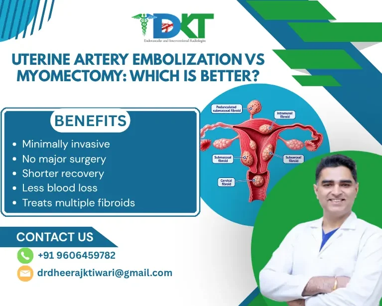 Uterine Artery Embolization vs Myomectomy: Which Is Better?