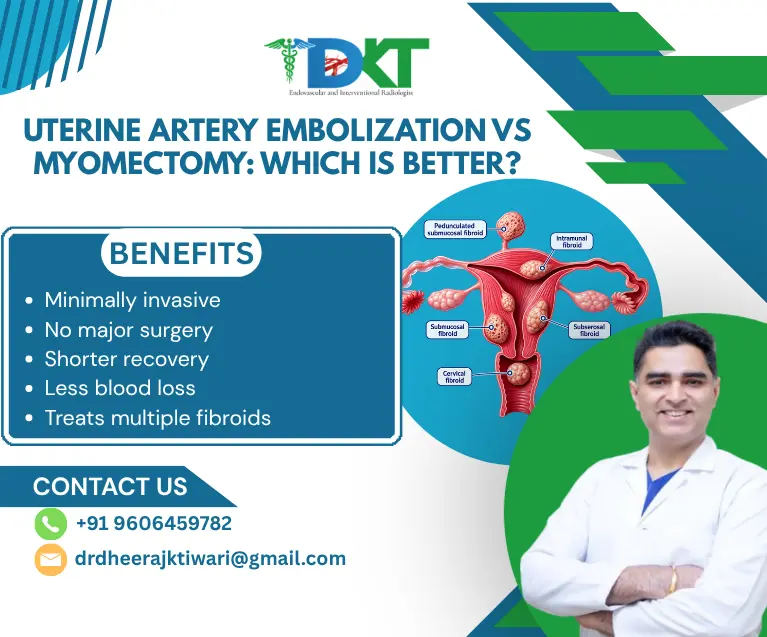 Uterine Artery Embolization vs Myomectomy: Which Is Better?