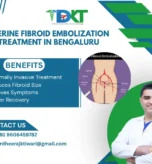 Uterine Fibroid Embolization Treatment in Bengaluru
