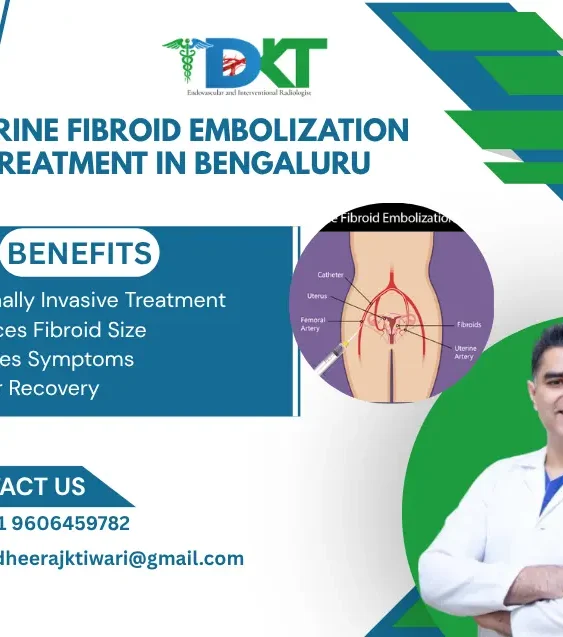 Uterine Fibroid Embolization Treatment in Bengaluru
