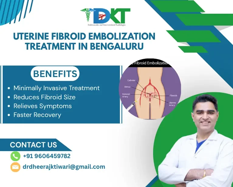 Uterine Fibroid Embolization Treatment in Bengaluru