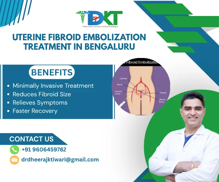 Uterine Fibroid Embolization Treatment in Bengaluru