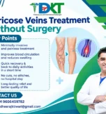 Varicose Veins Treatment Without Surgery in Bangalore