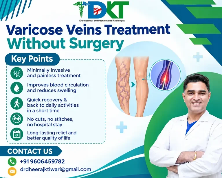 Varicose Veins Treatment Without Surgery in Bangalore