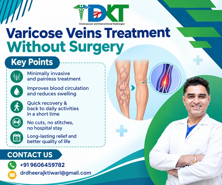 Varicose Veins Treatment Without Surgery in Bangalore
