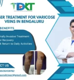 Laser Treatment for Varicose Veins in bengaluru