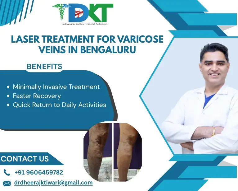Laser Treatment for Varicose Veins in bengaluru