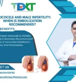 Varicocele and Male Infertility: When Is Embolization Recommended?