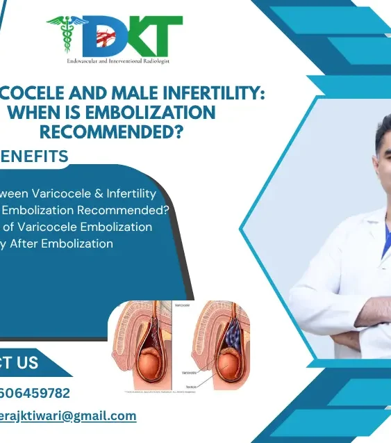 Varicocele and Male Infertility: When Is Embolization Recommended?