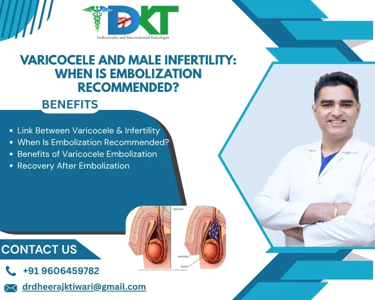 Varicocele and Male Infertility: When Is Embolization Recommended?