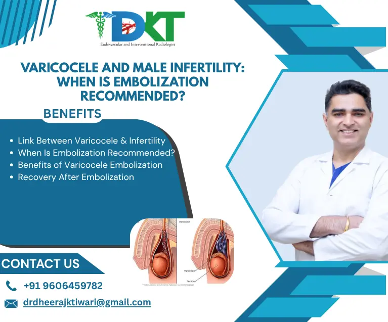 Varicocele and Male Infertility: When Is Embolization Recommended?